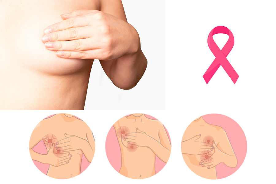 El cáncer de mama triple negativo desata la búsqueda urgente de una cura