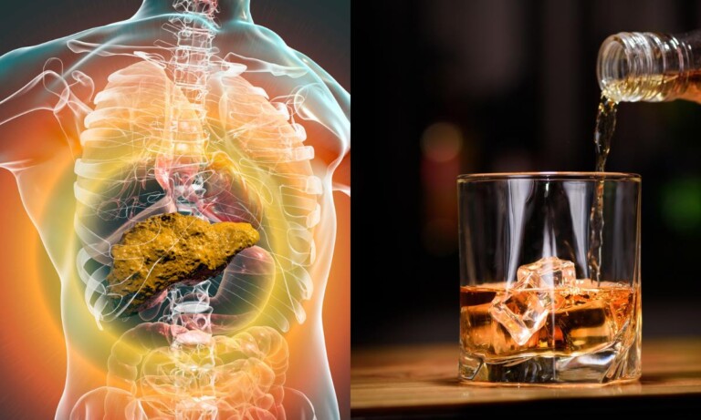 ¿El hígado puede recuperarse de los daños ocasionados por el consumo de alcohol?