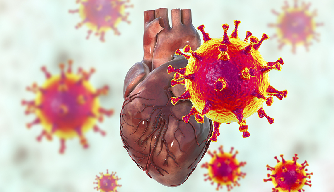 Infección pulmonar grave durante Covid-19 puede ocasionar daño al corazón